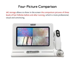 AI Intelligent Scalp Skin Analyzer Machine HD Hair Follicle Detector Portable Skin Hair Analysis Equipment US 3D Topography