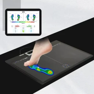 Smart Foot Pressure Plate – Real-Time Data, Compact Size, Enhance Health Monitoring Central Podiatry Clinic